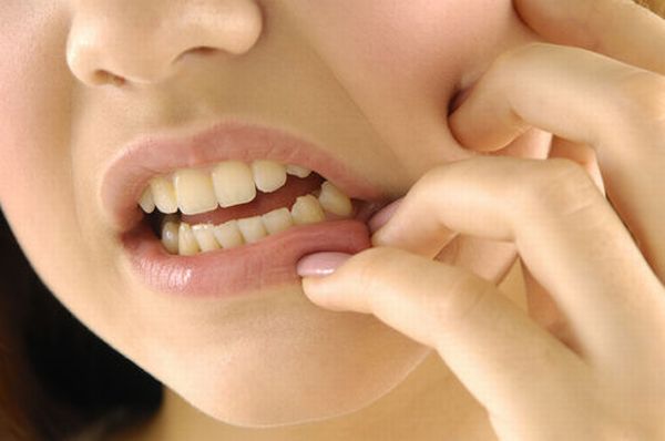 Cure e rimedi naturali per chi soffre di mal di denti